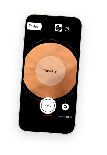 intellimago-app-hautscreening